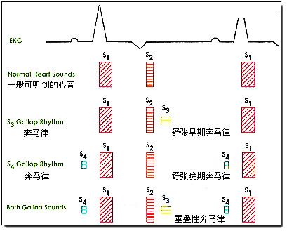 奔馬律|心音(醫學名詞):定義,詳細說明,聽診,心音圖,正常,異常,附加,舒張期。